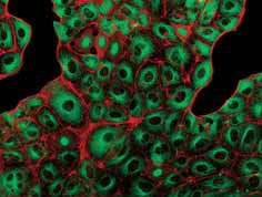 奧林巴斯顯微鏡BX63-1 奧林巴斯顯微鏡BX63-1