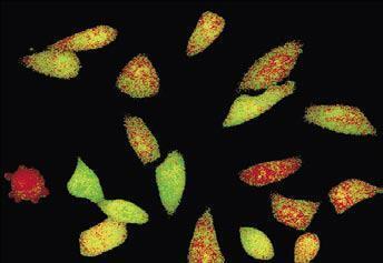 OLYMPUS活細胞工作站CELL R5 OLYMPUS活細胞工作站CELL R5