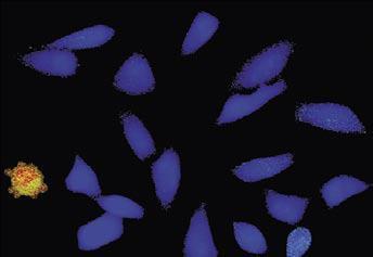 OLYMPUS活細胞工作站CELL R3 OLYMPUS活細胞工作站CELL R3