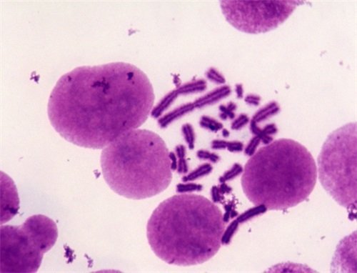 染色體核型分析顯微鏡2