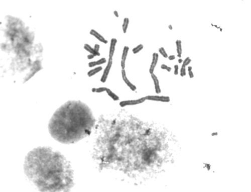 染色體核型分析顯微鏡3