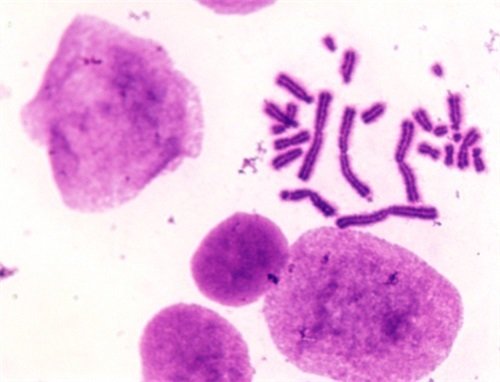 染色體核型分析顯微鏡4