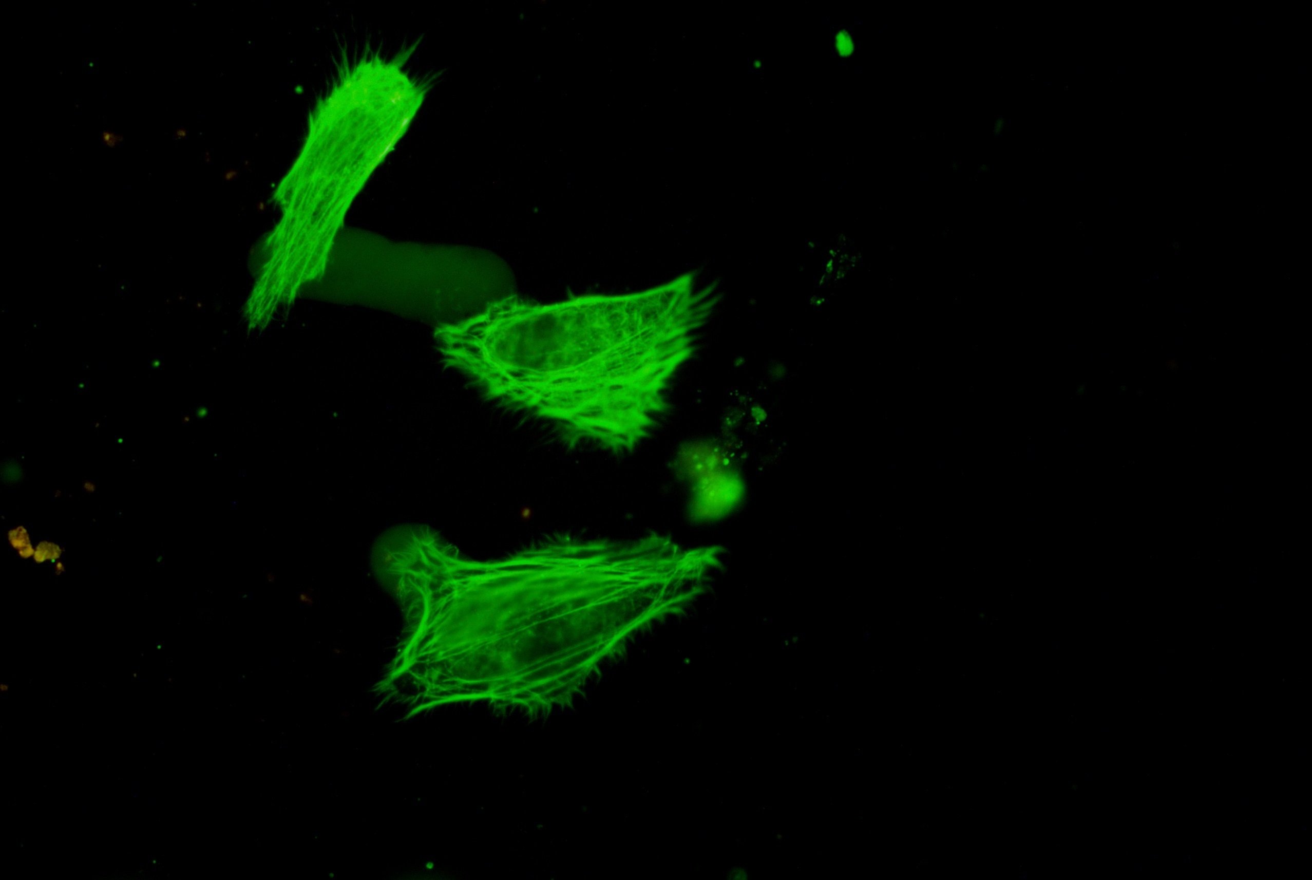 細胞骨架熒光案例拍圖2 細胞骨架熒光案例拍圖2