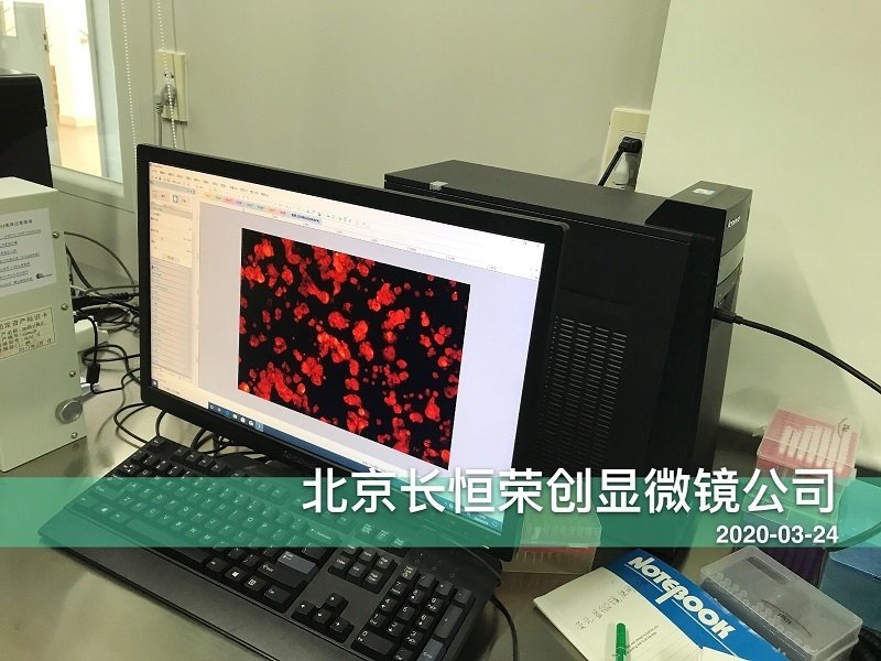 熒光顯微鏡拍照CCD安裝于河南大學(xué) 熒光顯微鏡拍照CCD安裝于河南大學(xué)