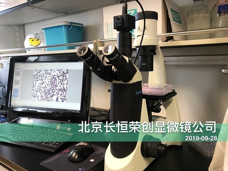 倒置數(shù)碼顯微鏡安裝于腫瘤醫(yī)院1
