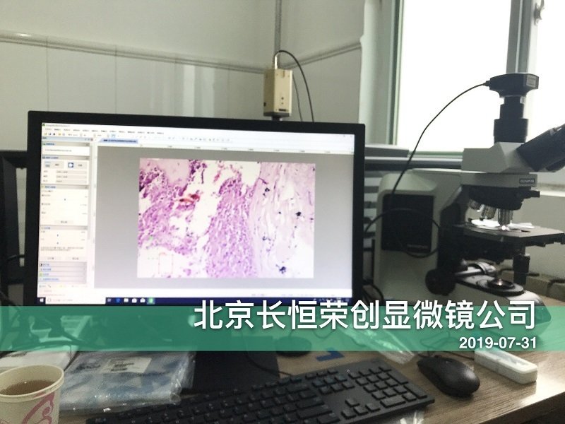 奧林巴斯BX53顯微鏡安裝于北京市婦幼保健醫(yī)院 奧林巴斯BX53顯微鏡安裝于北京市婦幼保健醫(yī)院