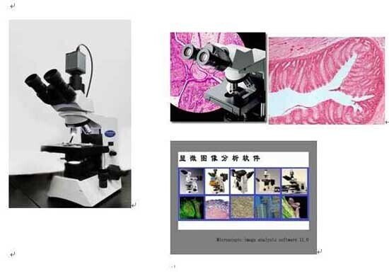 顯微鏡攝像頭安裝于中國科學院動物所