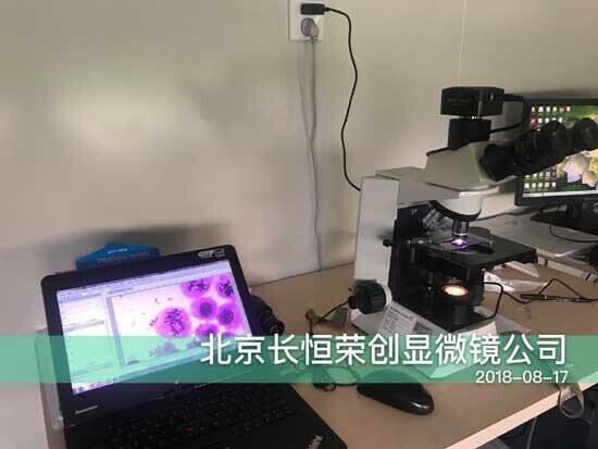 2018年 染色體觀察顯微鏡安裝于朝陽婦幼保健醫院1