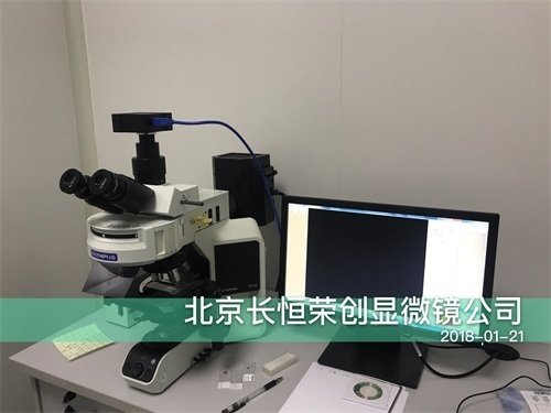 2018年 奧林巴斯熒光顯微鏡安裝于中國醫(yī)學(xué)科學(xué)院腫瘤中心1
