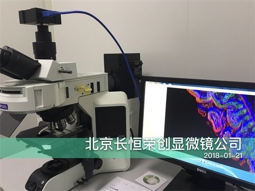 2018年 奧林巴斯熒光顯微鏡安裝于中國醫(yī)學(xué)科學(xué)院腫瘤中心3