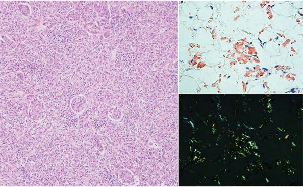 奧林巴斯顯微鏡CX43 奧林巴斯顯微鏡CX43
