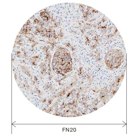 奧林巴斯顯微鏡CX43 奧林巴斯顯微鏡CX43