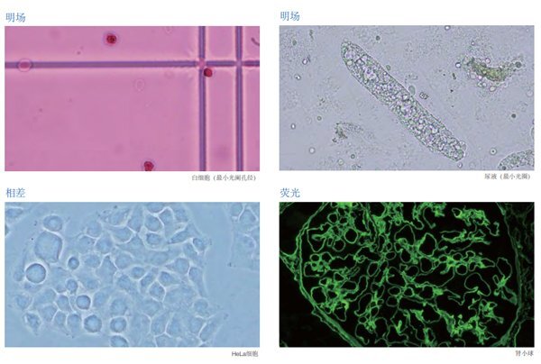 奧林巴斯顯微鏡CX43應(yīng)用場(chǎng)景 奧林巴斯顯微鏡CX43應(yīng)用場(chǎng)景