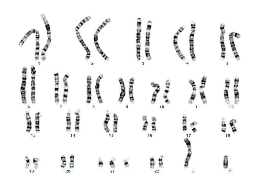染色體核型配對分析2
