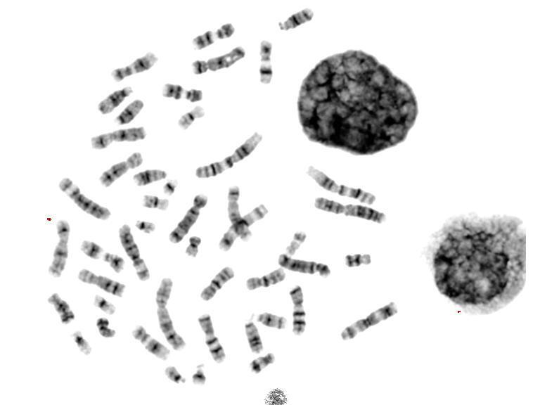染色體核型配對分析1