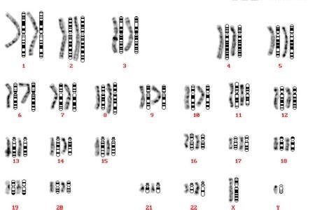 染色體核型配對分析 染色體核型配對分析