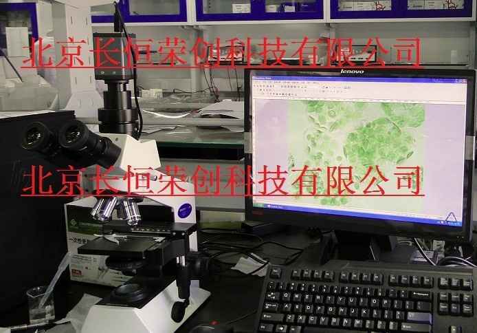 植物葉綠體觀察顯微鏡CX21-CV32011 植物葉綠體觀察顯微鏡CX21-CV32011